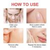 Acne Patches-Invisible Acne PATCHES-144 Acne Patches Of True Hydrocolloid Stickers For Face And Body